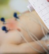 EKG Elektrokardiogramma