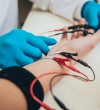 Neirogrāfija NG un Elektromiogrāfija EMG